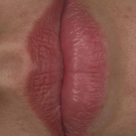 Abgeheiltes Permanent Make-Up: Lippen © Arisari INK