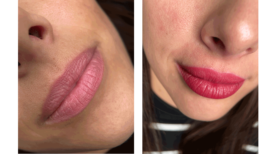 Vorher/Nachher Lippen