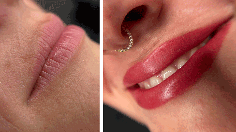 Vorher/Nachher Lippen
