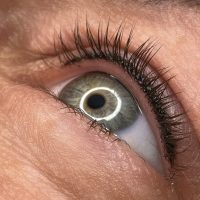 Wimpernkranzverdichtung