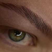 Browlifting 